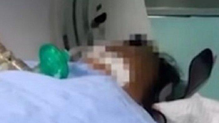 Sembilan Anggota Keluarga Tewas Usai Makan Mi Bongkrek yang Disimpan di Kulkas, Ini Penyebabnya