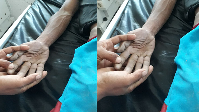 Korban Tewas di BLUD SPAM Nagekeo Tidak Gunakan Perlengkapan Kerja Standar