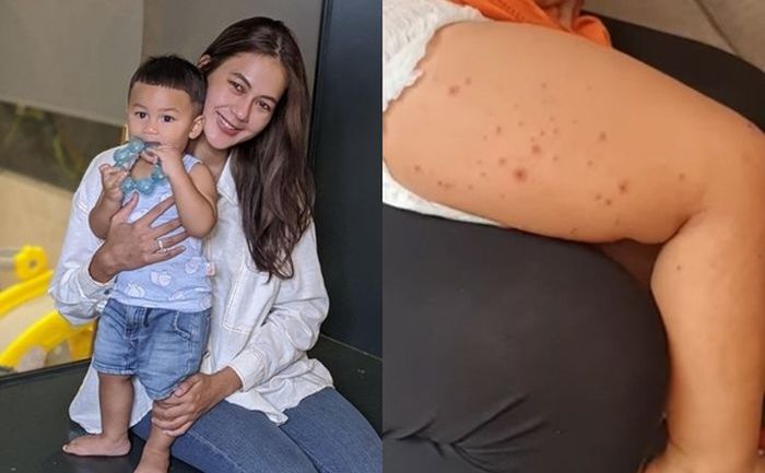 Kabar Sukda dari Keluarga Baim Wong, Sang Putra Kiano Tiger Wong Positif Flu Singapura, Paula Panik