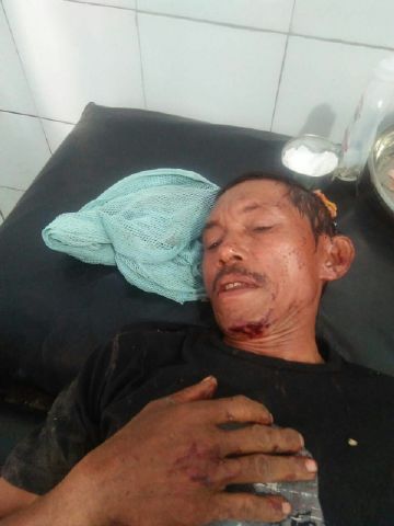 Gara-Gara Rebutan Tanah di Borong! Fransiskus Bacok Urbanus di Persawahan Golo