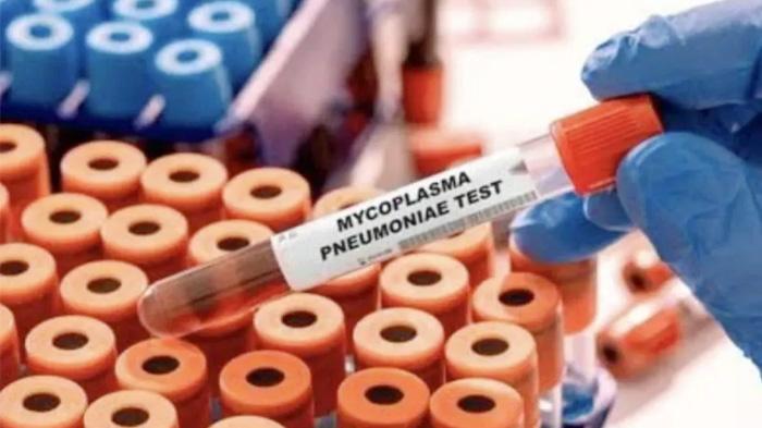 Masyarakat Diimbau Gunakan Masker Setelah Kasus Pneumonia Misterius Muncul di Jakarta