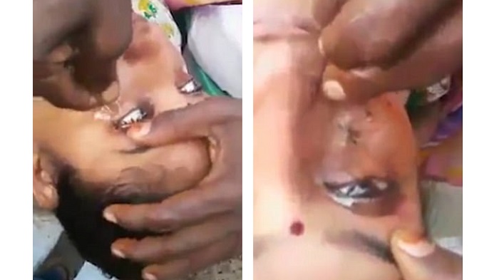 Ingin Mata Bersih dan Jernih? Coba Metode Ekstrem Satu Ini, Dijamin Bikin Bulu Kuduk Merinding!