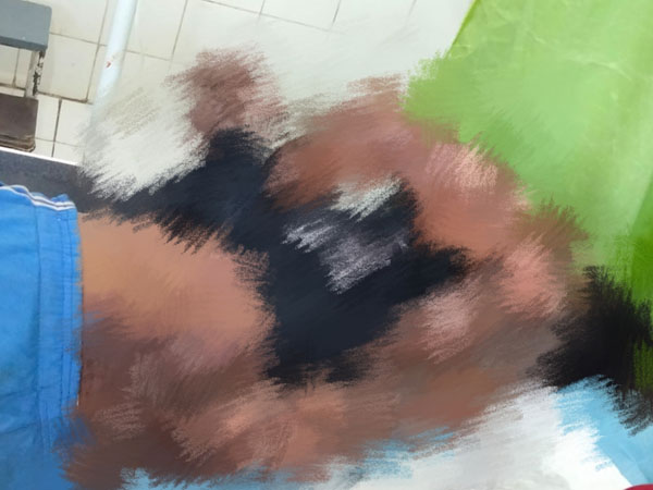 seorang-petugas-pln-di-ngada-tersengat-listrik-beruntung-masih-bisa-diselamatkan.jpg