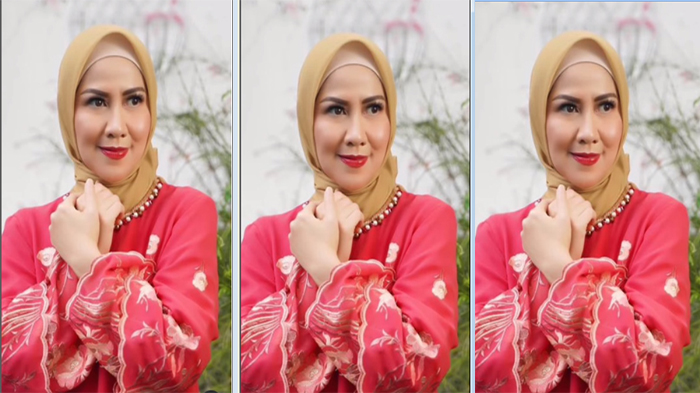 Venna Melinda Ungkap Kondisi Psikolisgisnya Usai 3 Kali Terapi Setelah Jadi Korban KDRT Ferry Irawan