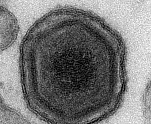 GAWAT! Virus Demam Babi Afrika Ancam NTT, Menyebar dari Timor Leste, Kenali Gejalanya