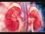Ilustrasi-Gangguan-Ginjal-Akut-Misterius.jpg