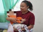 Kemensos-Tangani-Bayi-Tanpa-Anus-di-NTT-Orang-Tua-Merasa-Sangat-Diperhatikan.jpg