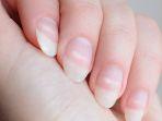 bintik-putih-pada-kuku.jpg