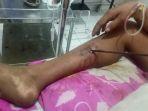 breaking-news-di-lembata-ntt-gara-gara-air-suami-tikam-istri-dengan-panah-ikan.jpg