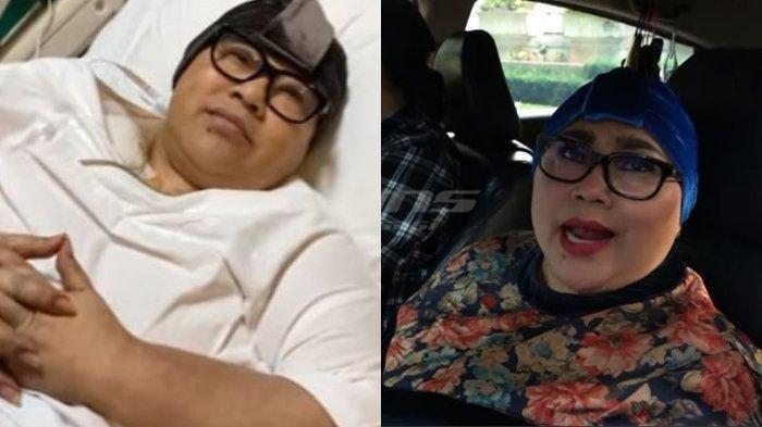 Nunung Tetap Aktif Bekerja, Jadi Cara Sembuh dari Kanker