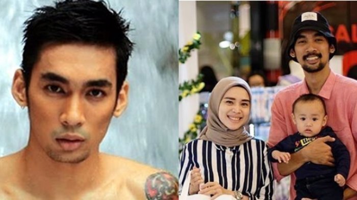 Artis Cantik Curhat Penyakit Suaminya Kini Terulang Lagi, Dulu Pernah Koma hingga Hilang Ingatan