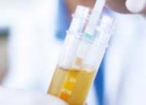 Maba Wajib Lampirkan Hasil Tes Urine