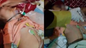 Kakak-Adik-Alami-Cacingan-Parah.jpg