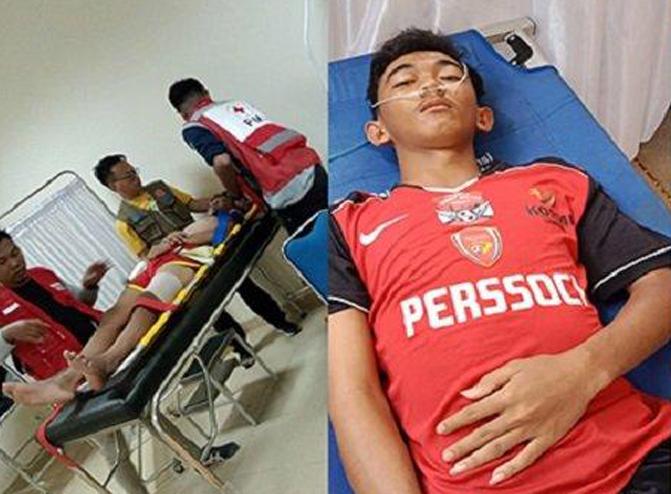 4 Pemain Perssoci Lampung Cedera Usai Hadapi Permainan Keras Tim DKI Jakarta