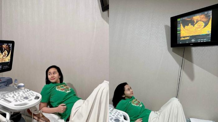Denise-Chariesta-membagikan-beberapa-foto-USGnya-walau-kenyataannya-ia-hamil-di-luar-pernikahan.jpg