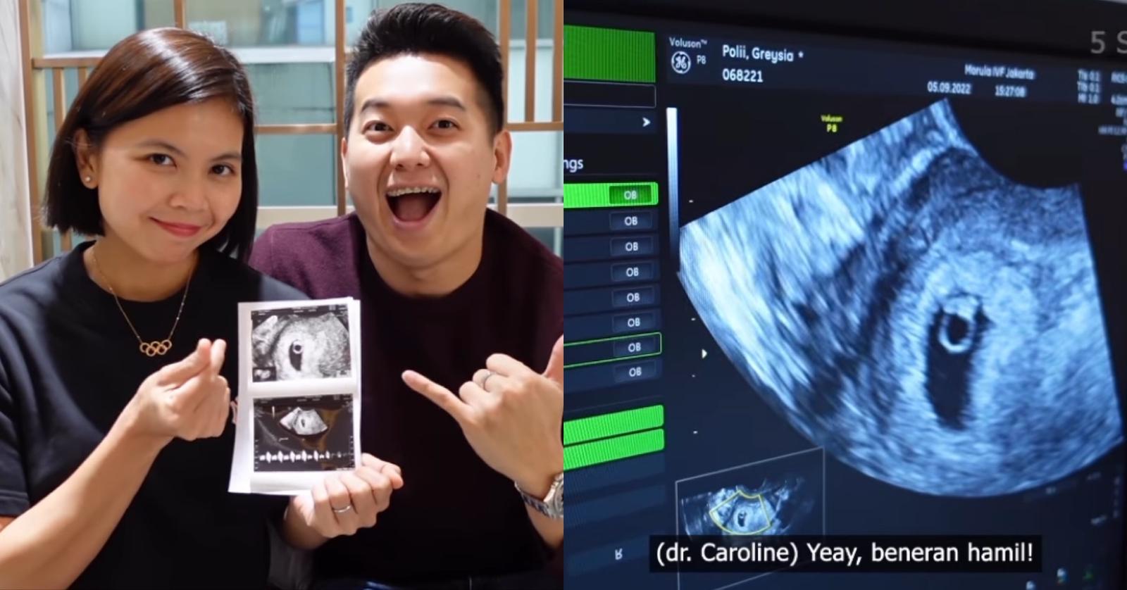 Greysia Polii Umumkan Hamil Anak Pertama Usai 2 Tahun Menikah