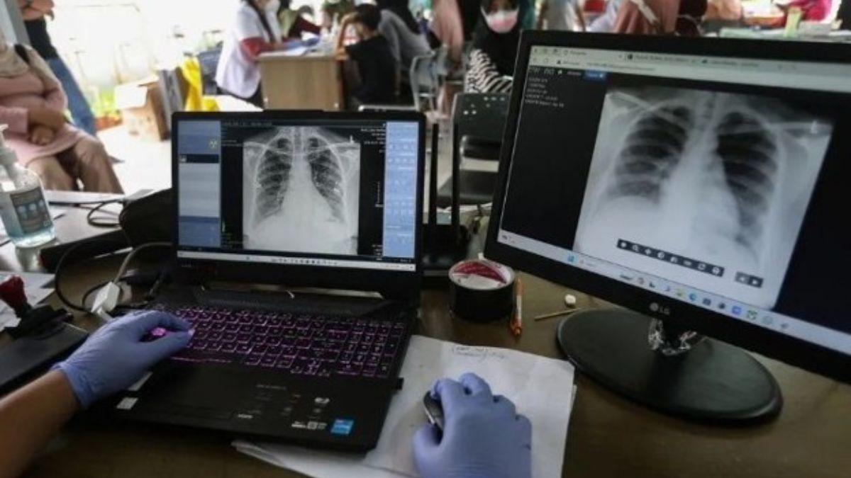Kejar Eliminasi TB 2030, Kemenkes Perluas Pemanfaatan Portable X-Ray di Puskesmas - Tribunlampung.co.id