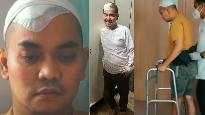 Indra Bekti Akan Jalani Operasi untuk Sedot Gumpalan Darah di Mata