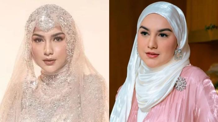 Irish Bella Hilangkan Pipi Tembemnya Kurang Dari 1 Jam