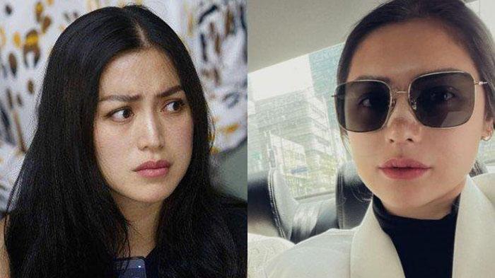 Jessica-Iskandar-bongkar-sumber-dana-buat-biaya-operasi-plastik-di-Korea.jpg
