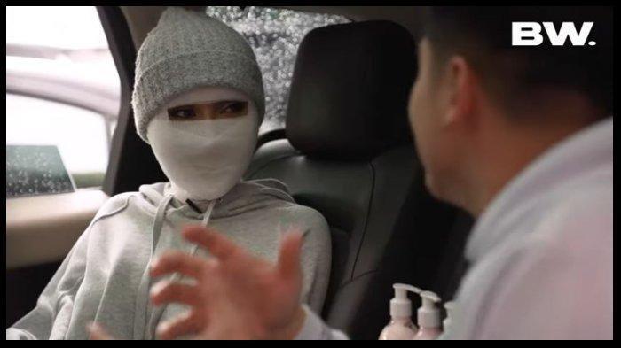 Lucinta  Luna Kapok Kayang dengan Wajah Diperban, Jahitan Operasi Sobek Lagi