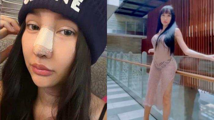 Lucinta Luna Pamer Bentuk Hidung Baru Rp 400 Juta 'Senggol Bos'