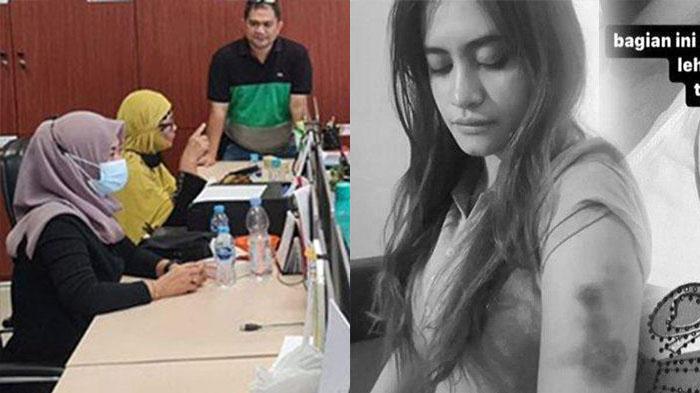 Polwan Aniaya Pacar Adiknya hingga Babak Belur, 'Pak RW yang Dibentak Juga Meninggal'
