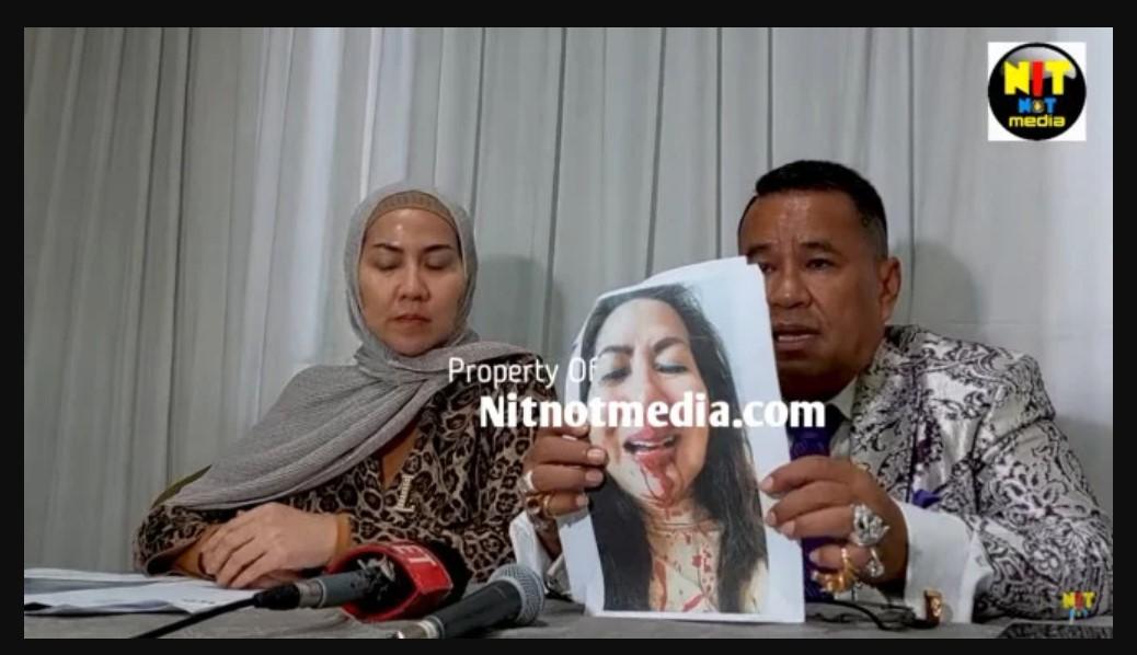 Reaksi Hotman Paris Saat Venna Melinda Difitnah Pukuli Diri Sendiri hingga Berdarah
