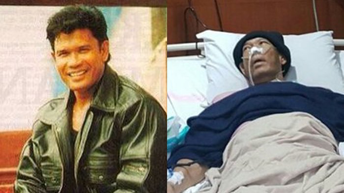 Soal Sakit Advent Bangun, Begini Kata sang Istri