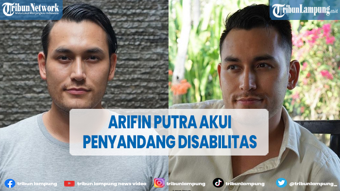 artis-arifin-putra-mengaku-penyandang-disabilitas-sejak-dilahirkan.jpg