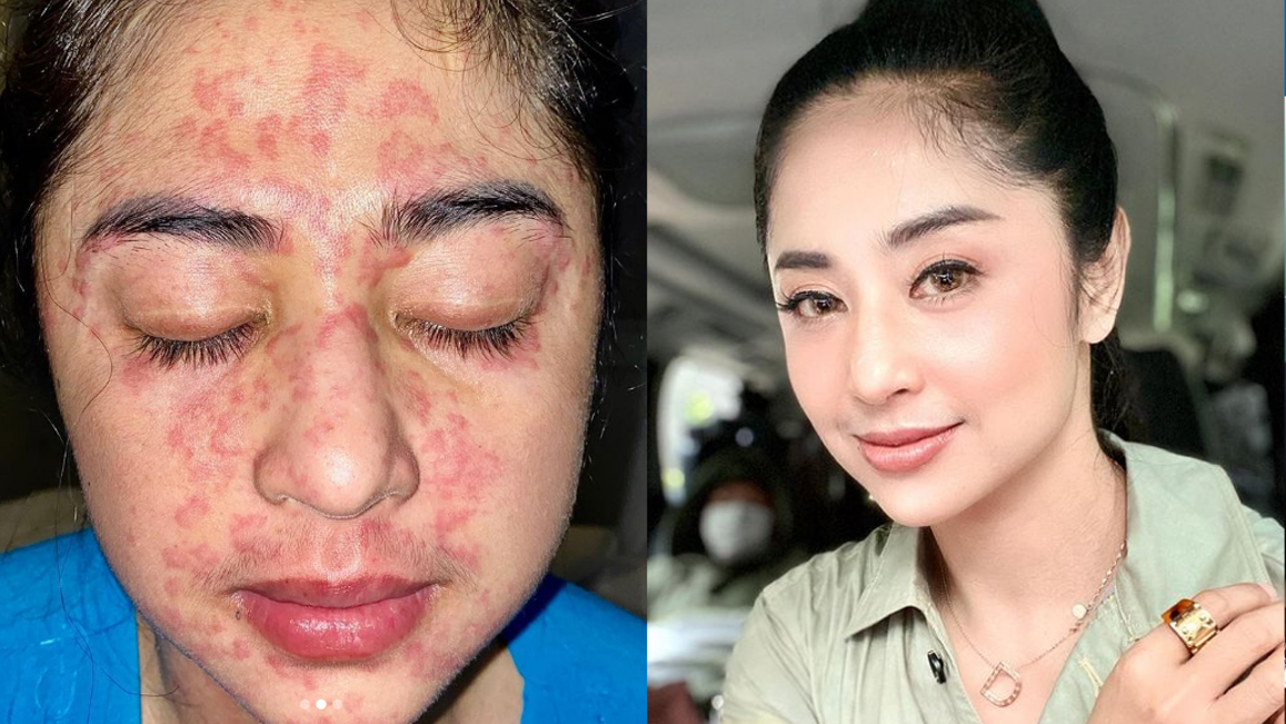 artis-dewi-perssik-ungkap-kondisinya-bagikan-hasil-swab-terbaru.jpg