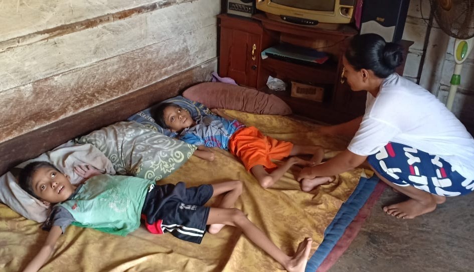 Kisah Pilu Bocah Kembar di Lampung Utara Terjangkit Polio, 15 Tahun Terbaring di Tempat Tidur