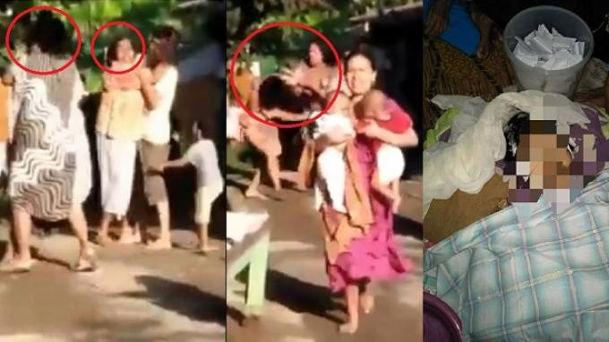 Emak-emak Berkelahi Hingga Tewas - Bekas Jahitan Operasi Caesar Robek