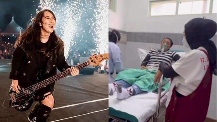 Kondisi Chua Kotak Setelah Masuk IGD, Ada Larangan saat di Panggung