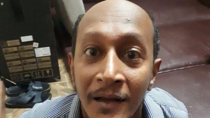 Ini Penyakit yang Diderita Penembak Dokter Lety