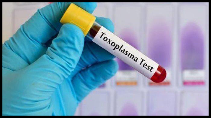 halo-dokter-cara-mengobati-toksoplasmosis.jpg