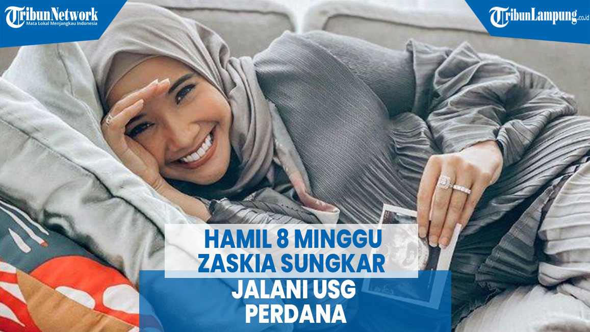 hamil-8-minggu-zaskia-sungkar-jalani-usg-perdana.jpg