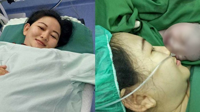 Melahirkan Caesar - Curhat Ibu Ditindih Dokter hingga Bagian Ini Dicukur