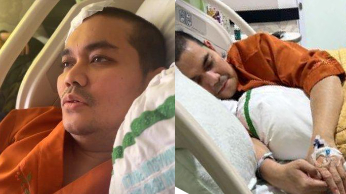 Indra Bekti Akan Operasi Mata, Aldila Jelita Mohon Doanya