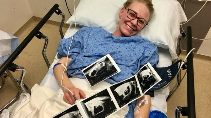 Subhanallah, 5 Tahun Menunggu Akhirnya Pasangan Ini Diberi Anak Kembar 5