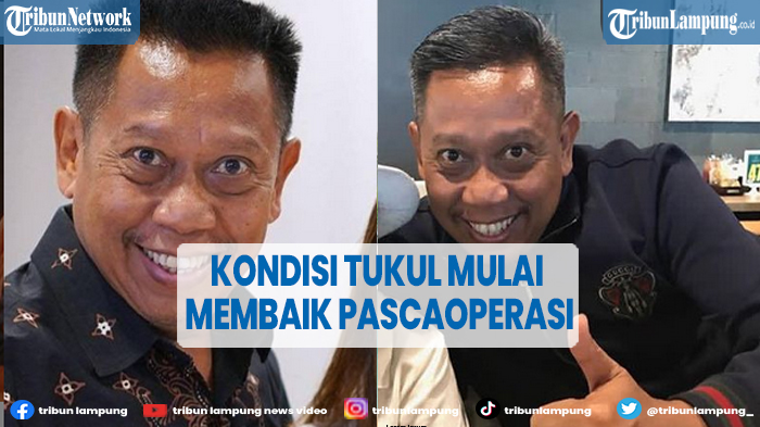 Meski Masih di Ruang ICU, Tukul Arwana Kondisinya Berangsur Membaik Pasca Operasi