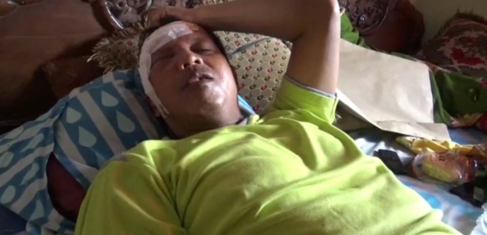 Tertimpa Lemari, Tukul Korban Longsor di Kaliawi Luka 25 Jahitan