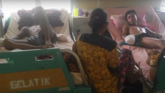 Tiba-tiba Duaarr! Daging Kulit Tangan Kakak Beradik Ini Hancur, Ibunya Langsung Pingsan