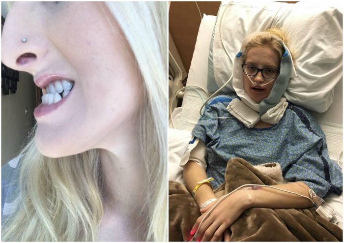 Sering Dibully Karena Bentuk Dagunya Aneh, Wanita Ini Lakukan Operasi dan Hasilnya Begini