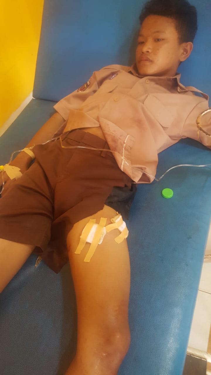 pelajar-kotabumi-ditembak-begal_20180901_182827.jpg