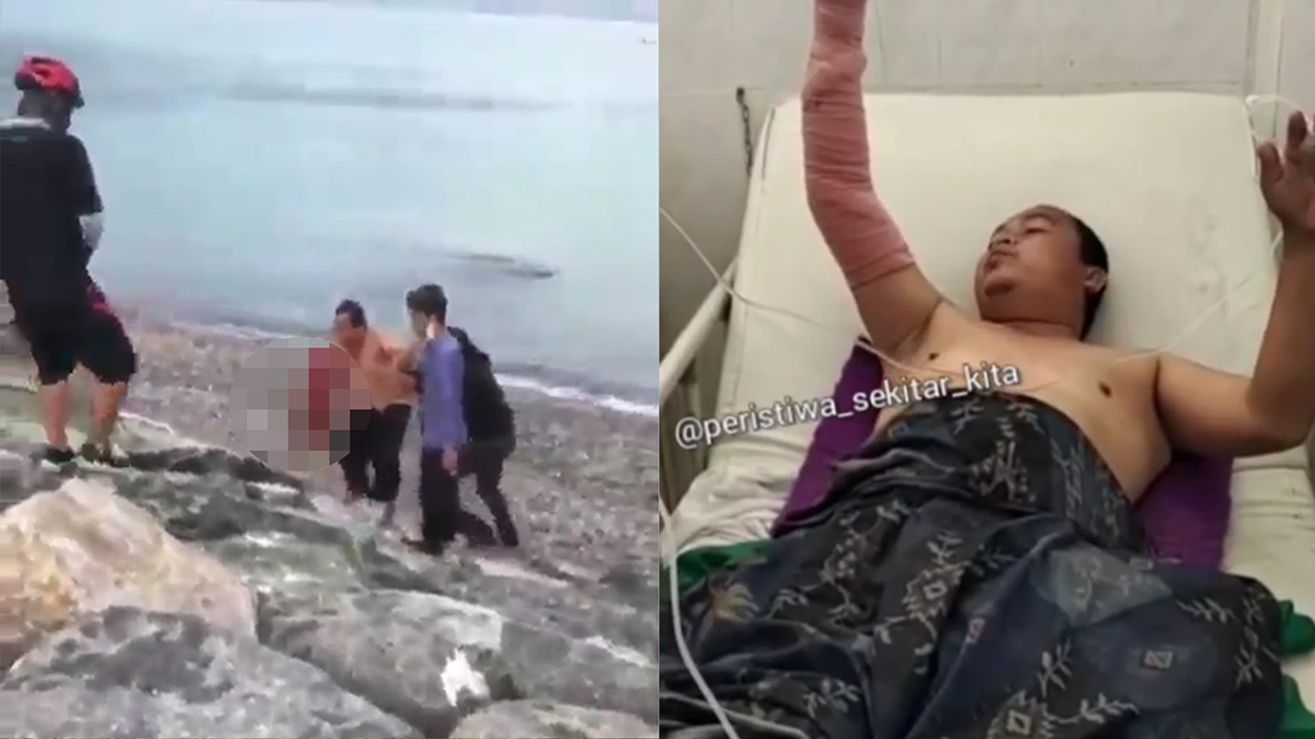 Pengakuan Pria yang Digigit Buaya Saat Berenang di Pantai hingga Terseret 20 Meter