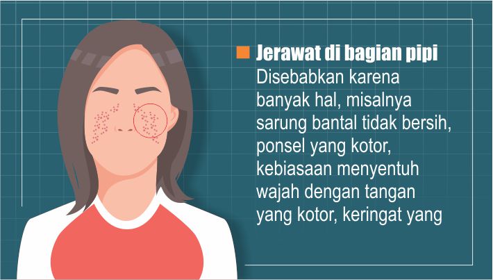penyebab-jerawat_20181106_104300.jpg