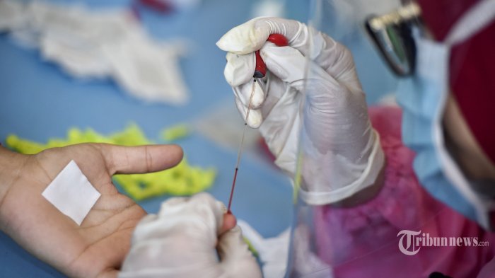 7 Kerabat Pasien 07 di Metro Rapid Test, Hasilnya Nonreaktif