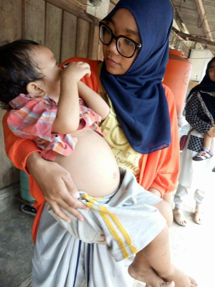 Rasa Sakit dan Tangis Rafiki karena Tumor di Perut