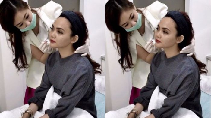 Rina Nose Tiba tiba Muncul  Bersama Dede Yusuf, Netizen Ingatkan Soal Ini